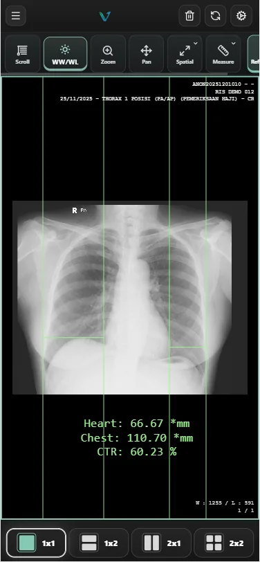 VELO Mobile Viewer