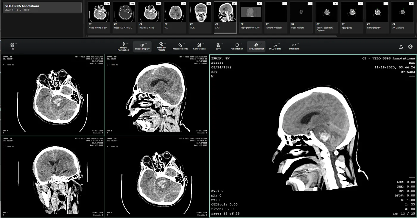 VELO PACS Viewer - Advanced Medical Imaging